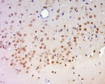 CCDC160 Polyclonal Antibody