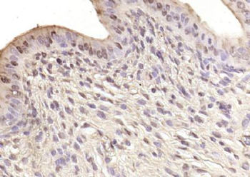 ARS2 Polyclonal Antibody