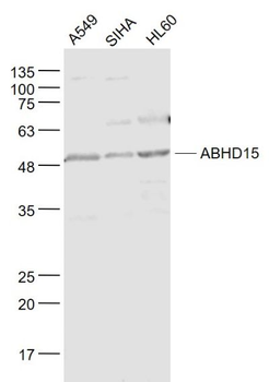 ABHD15 Polyclonal Antibody