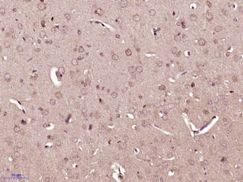CEND1 Polyclonal Antibody