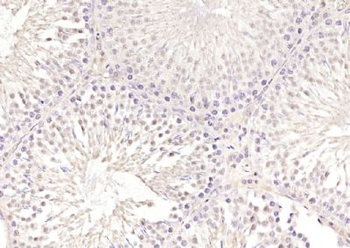 SKA3 Polyclonal Antibody