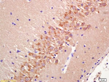 FMN2 Polyclonal Antibody