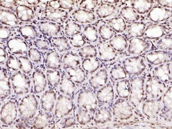 SPC25 Polyclonal Antibody