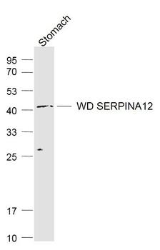 SERPINA12 Polyclonal Antibody