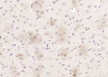 Limd1 Polyclonal Antibody