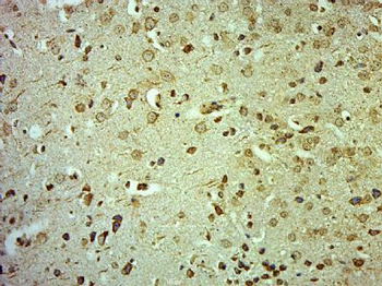 CLCN3 Polyclonal Antibody