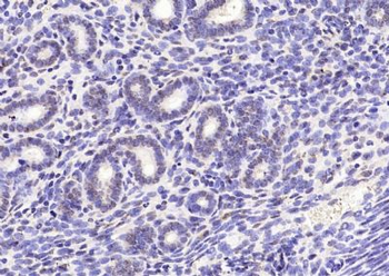 CENPT Polyclonal Antibody