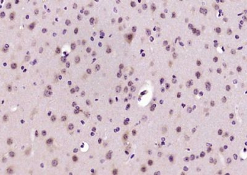 CARD7/NALP1 Polyclonal Antibody