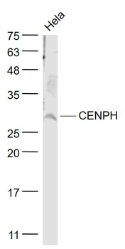CENPH Polyclonal Antibody