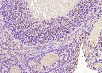 FAM107A Polyclonal Antibody