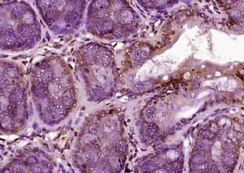 Matrin 3 Polyclonal Antibody
