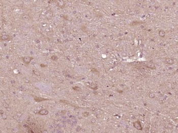 COL4A3BP Polyclonal Antibody