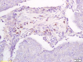 DBC2 Polyclonal Antibody