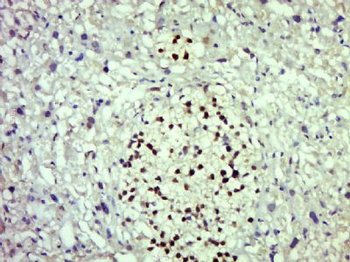 Myt1 Polyclonal Antibody