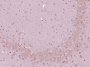 Urocortin 3 Polyclonal Antibody