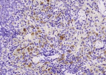 MD1 Polyclonal Antibody