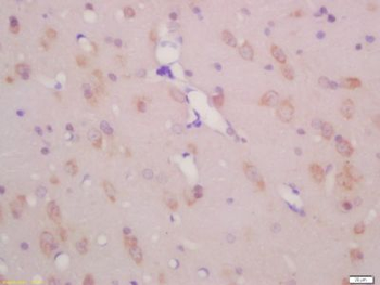 KCNC3 Polyclonal Antibody