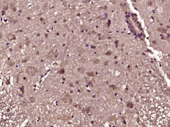 SLC22A4 Polyclonal Antibody