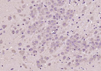 EDG8 Polyclonal Antibody