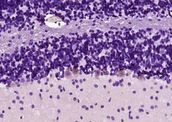 KIF3A Polyclonal Antibody