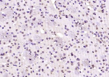 SLX4/BTBD12 Polyclonal Antibody
