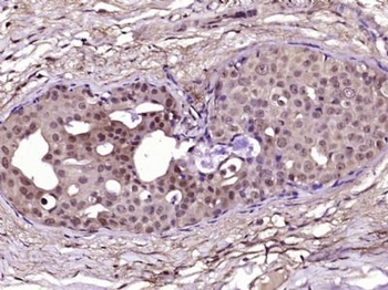 ALPK3 Polyclonal Antibody