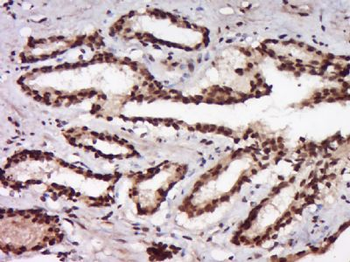 FAM166A Polyclonal Antibody