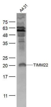 TIMM22 Polyclonal Antibody