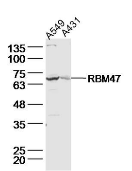 RBM47 Polyclonal Antibody