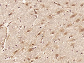 RAD26L/C9orf102 Polyclonal Antibody