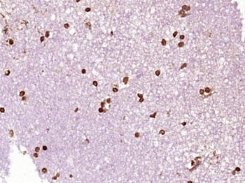 Nucleoplasmin 3 Polyclonal Antibody