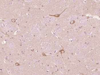 NMNAT2 Polyclonal Antibody