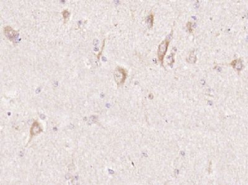 NLRC5 Polyclonal Antibody