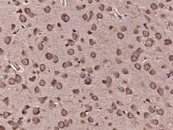 MYO15A Polyclonal Antibody