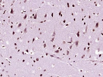 NDST4 Polyclonal Antibody