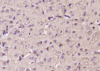 MFSD8 Polyclonal Antibody