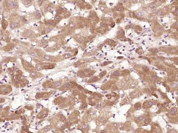 RSPH6A Polyclonal Antibody