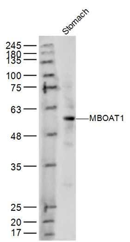 MBOAT1 Polyclonal Antibody