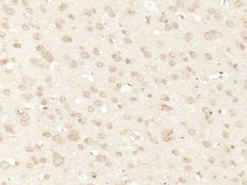 MAGOH/Mago nashi homolog 2 Polyclonal Antibody