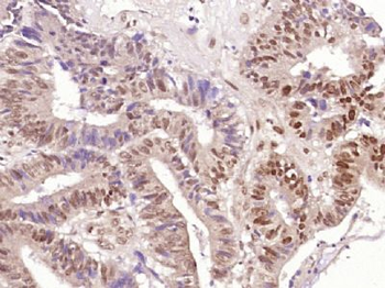 ZCPW1 Polyclonal Antibody