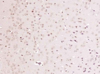MAB21L1 Polyclonal Antibody
