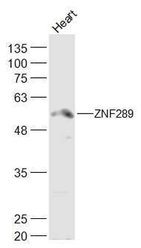 ZNF289/ARFGAP2 Polyclonal Antibody