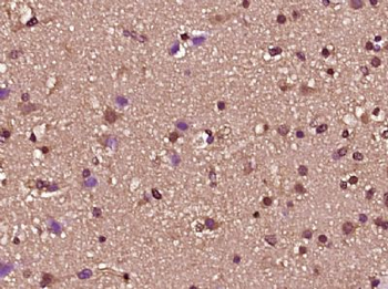 ZNF2 Polyclonal Antibody