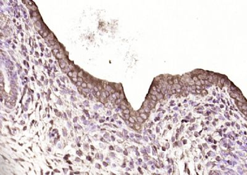SAKS1/2B28 Polyclonal Antibody