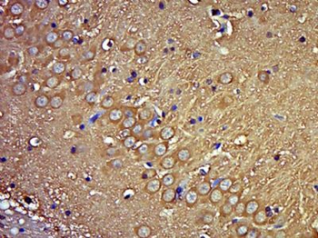 HYLS1 Polyclonal Antibody