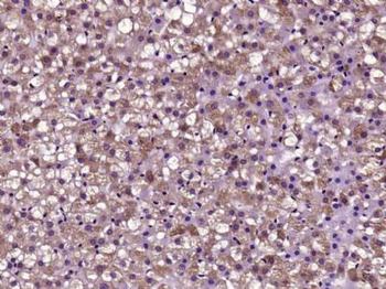 HUS1B Polyclonal Antibody