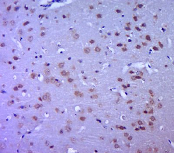 MTX1 Polyclonal Antibody