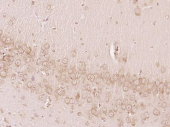 MTMR7 Polyclonal Antibody