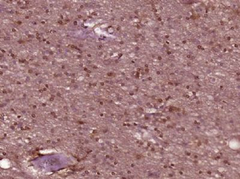 SPIN2B Polyclonal Antibody