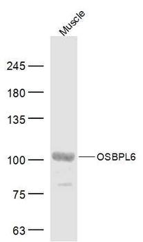 OSBPL6 Polyclonal Antibody